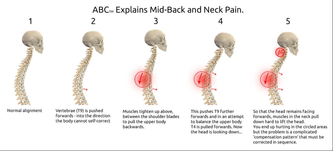 Why do I have neck pain?